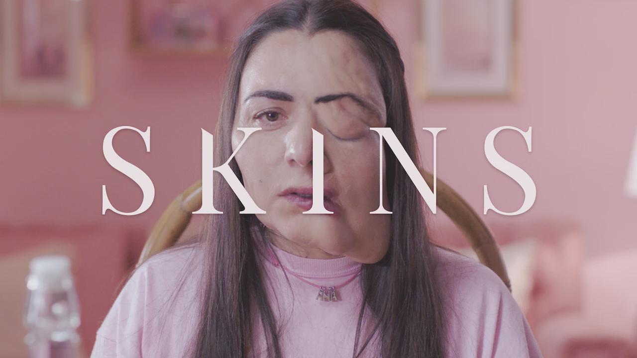 Skins – Skins